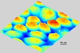 Epithelial cancer cells as seen by quantitative phase imaging.