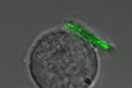 MIT researchers have developed a technique to attach tiny polymer "backpacks" to cells. This immune system cells, a B lymphocyte sports one. The scale bar is 10 micrometers.