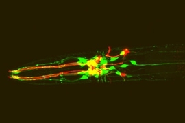 C. elegans expressing red fluorescent protein in dopamine neurons and green fluorescent protein in dopamine receptor-expressing neurons.