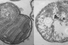 A newly discovered gene in bacteria may help microbes survive in low-oxygen environments. A bacterial cell with the gene, left, exhibits protective membranes. A cell without the gene, right, produces no membranes.