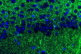 The tips of long neuronal extensions from the amygdala (green) contact neurons of the hippocampus (blue). This communication pathway helps to modulate anxiety.