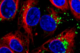 MIT engineers designed nanoparticles that can deliver short strands of RNA (green) into cells (nuclei are stained blue).