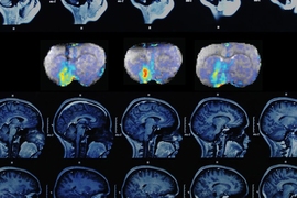 A series of three MRI images (top row) shows how dopamine concentrations change over time in the brain's ventral striatum.