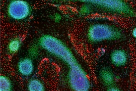 This image demonstrates tissue patterns that emerge from genetically programmed human pluripotent stem cells, and was taken on day nine of the MIT study. It shows immunostainings of cell nuclei for CEBPA (red, endodermal marker), SOX10 (green, ectodermal marker), and DAPI (blue, binds to DNA in the nucleus). 
