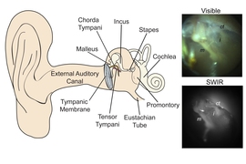 This diagram shows the structures of the middle ear, along with examples of the kinds of images provided by today’s conventional visible-light otoscopes (top) and by the newly developed short-wave infrared (SWIR) otoscope. The new otoscope can probe deeper to provide clearer indications of the presence of fluid which can indicate an infection.
