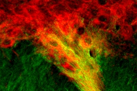 MIT neuroscientists have identified tight connections between dopamine-producing cells of the substantia nigra (red) and neurons in the striatum (green). These connections, which show up as yellow, may play a role in the brain’s decision-making processes.
