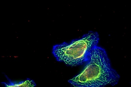 This image shows triple-negative breast cancer cells with high levels of “Mena invasive” protein and treated with Paclitaxel. The cell cytoskeleton is shown in blue, the dynamic microtubules are shown in green, and the stable microtubules are shown in red. 
