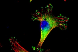 This image shows triple-negative breast cancer cells with the Mena invasive protein marked in green and the microtubules in red. 
