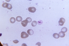 The Malaria parasite. A team of MIT biological engineers has developed a method to measure levels of the iron-containing protein heme inside the malaria parasite.
