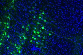 The dorsal hippocampus receives spatial and temporal information from an upstream brain region known as the medial entorhinal cortex (MEC). Green staining shows MEC engram cells, which store a long-term fear memory and have the light sensitive optogenetic protein channelrhodopsin-2. Blue staining shows all cells in the MEC brain region, including non-engram cells (blue color staining only). 
