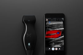 Butterfly Network, a startup co-founded by MIT alumnus Nevada Sanchez ’10, SM ’11, has developed a low-cost, handheld scanner that generates clinical-quality ultrasounds on a smartphone. Ultrasounds are uploaded to the cloud, where any expert with permission can give second opinions or help analyze images. 
