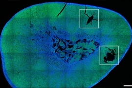 MIT engineers have developed magnetic nanoparticles (shown in white squares) that can stimulate the adrenal gland to produce stress hormones such as adrenaline and cortisol.