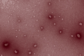 An image captured through transmission electron microscopy shows the nanoparticles used to further stimulate the immune system to fight cancer.