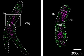 These cross-sections of the thalamic reticular nucleus (TRN) show two distinct populations of neurons, labeled in purple and green. A team of researchers from MIT and the Broad Institute of MIT and Harvard has now mapped the TRN in unprecedented detail.