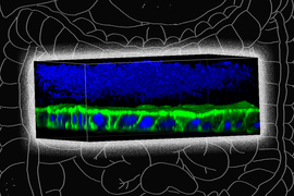 microbiome model