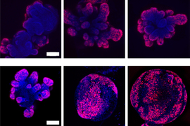 cell division marker Ki67