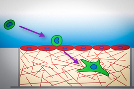 tumor cell diagram