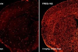 oligodendrocytes