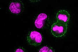 lysosomal exocytosis graphic