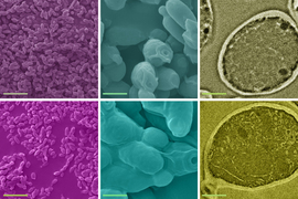 comparison of non contaminated yeast cells and contaminated yeast cells