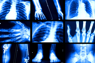 X-ray images